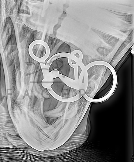 Fager Carl Titanium Fixed rings