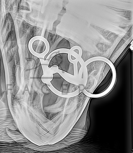 Fager Carl Titanium Fixed rings